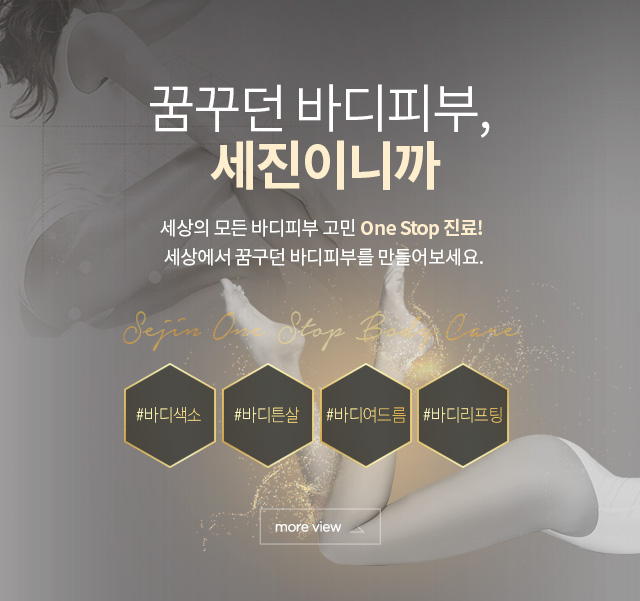 튼살