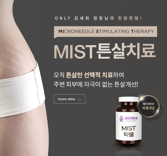 MIST튼살치료