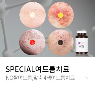 여드름치료