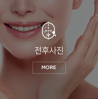 전후사진
